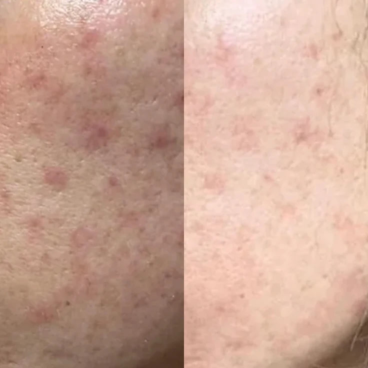 Das ist mittlerweile eines meiner liebsten Skincare-Produkte.