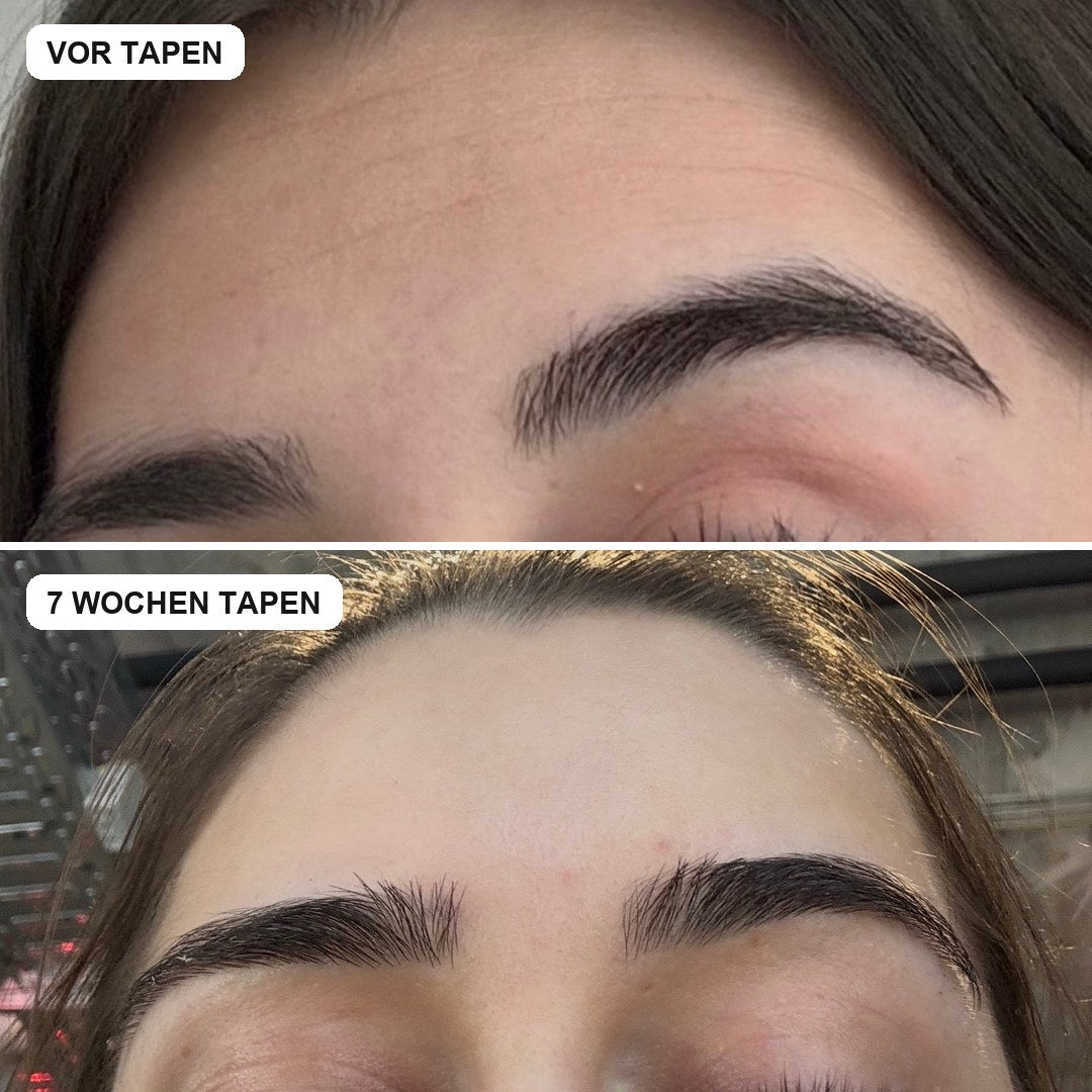 Vorher und nachher mit Face Tapes