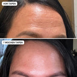 Vorher und nachher mit Face Tapes