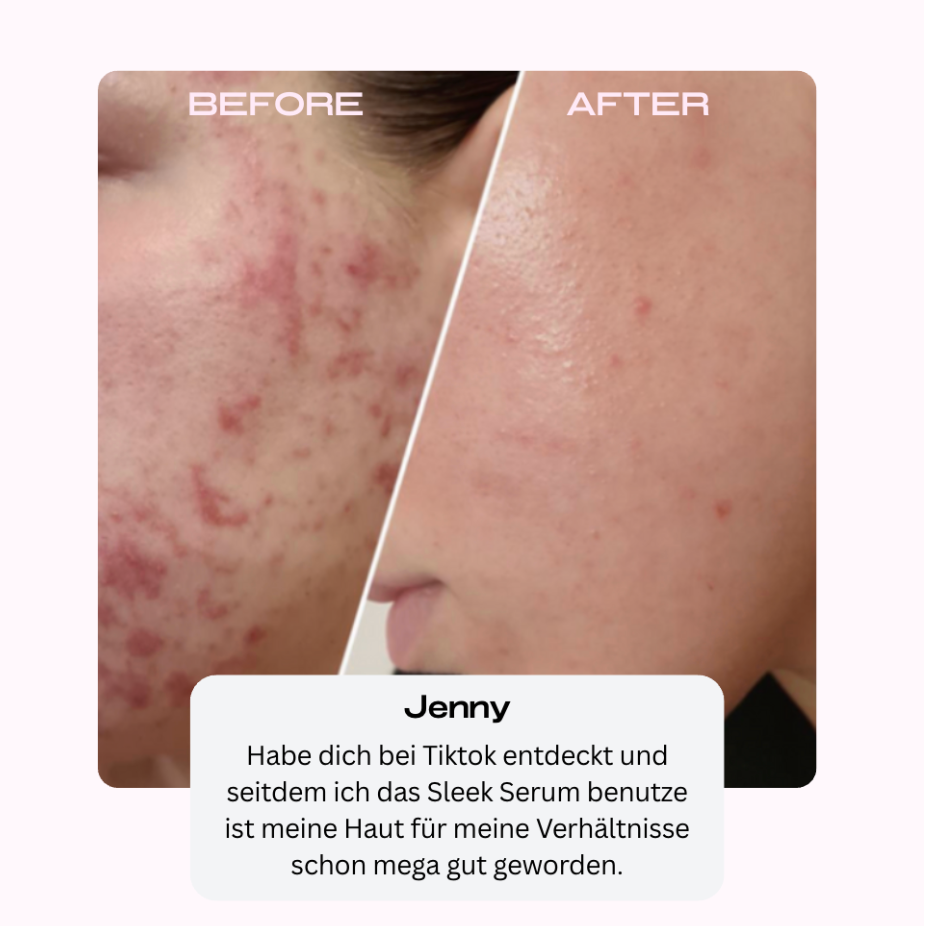 Sleek Skin Serum 30ml