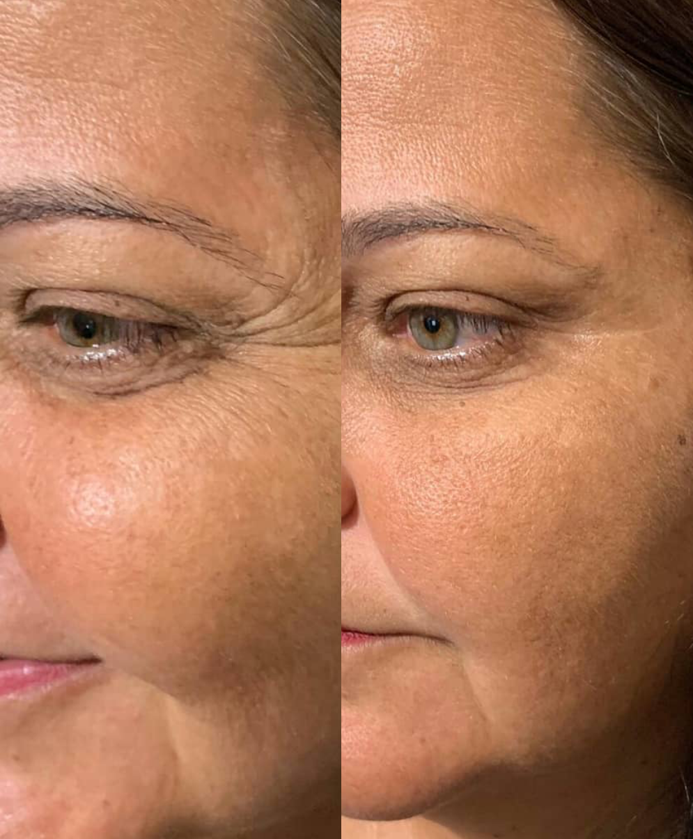 Sleek Skin Serum 30ml