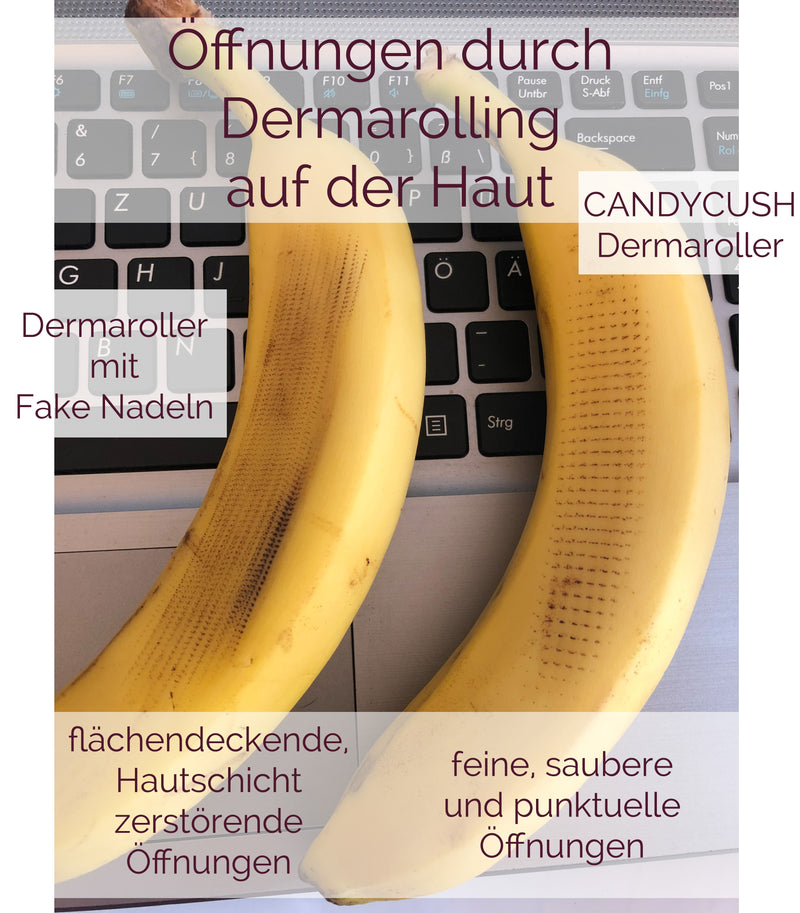 [Beste Hautpflegeprodukte zur Entfernung von Aknenarben und Pickeln]-CANDYCUSH