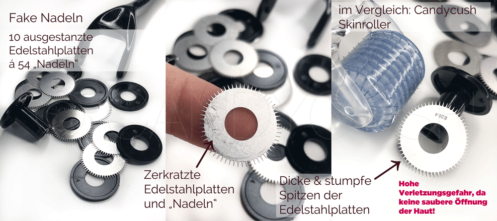 [Beste Hautpflegeprodukte zur Entfernung von Aknenarben und Pickeln]-CANDYCUSH